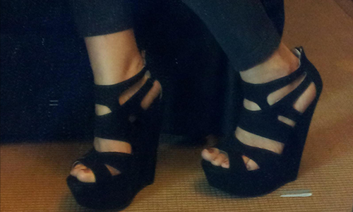  Wedges