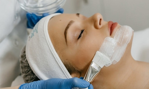 chemical-peel-treatment