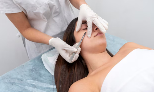 Dermaplaning-procedure