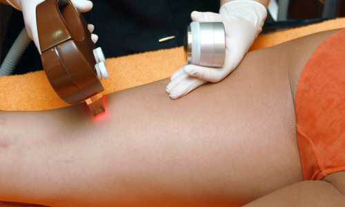 Red-light-therapy-on-woman’s-legs