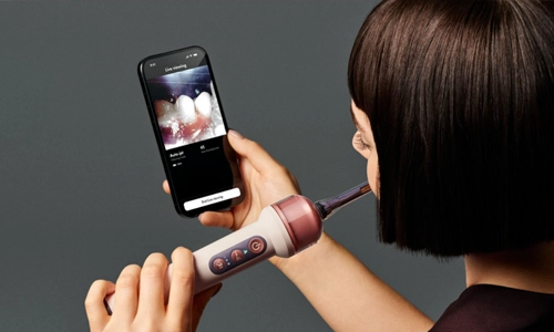 Dyson CameraJet™ is Wi-Fi connected through the MyDyson™ app, users can access guided cleaning, how-to films, brushing and flossing insights